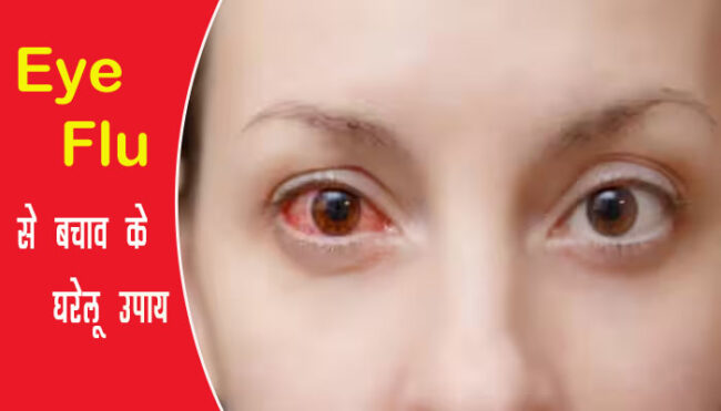 Eye Flu: आई फ्लू के संक्रमण में इन घरेलू उपायों से मिलेगी राहत