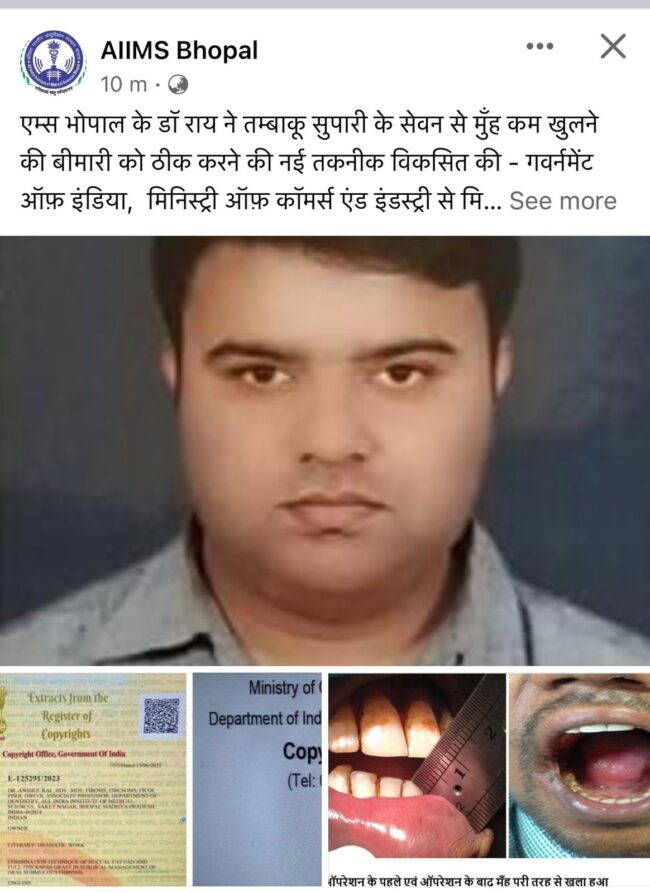 Betul News : डॉ. राय ने तलाशी मुंह की बीमारी की नई तकनीक