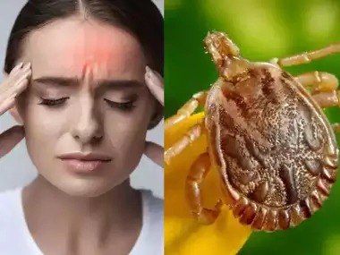 Viral Infection News : जिले में वायरल के साथ स्क्रब टायफस का बढ़ा खतरा, चिकित्सकों की सलाह- बुखार , सर्दी , खांसी को हल्के में ना लें नागरिक