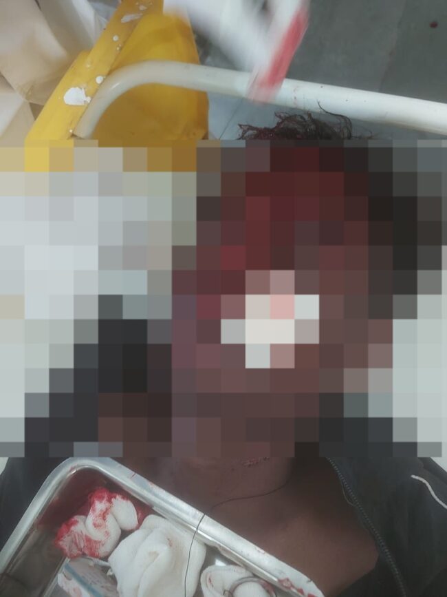 Betul Crime: पूर्व भाजपा जिला अध्यक्ष के आवास के सामने युवक पर चाकुओं से ताबड़ातोड़ वार