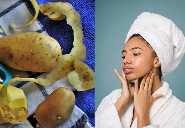 Potato Peel Benefits : आलू ही नहीं उसके छिलके में भी होते है कमाल के औषधीय गुण, जानें फायदे