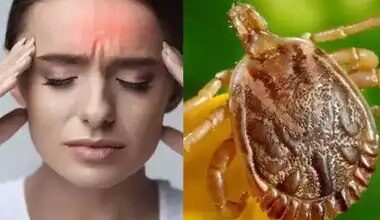 Viral Infection News : जिले में वायरल के साथ स्क्रब टायफस का बढ़ा खतरा, चिकित्सकों की सलाह- बुखार , सर्दी , खांसी को हल्के में ना लें नागरिक